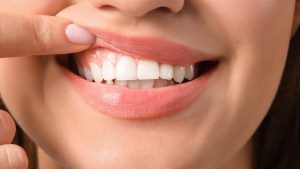 woman showing off her smile