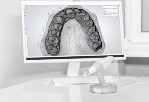 Dental,3d,Scanner